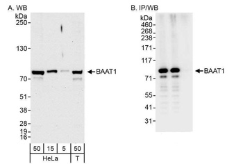 Rabbit BAAT1 Antibody