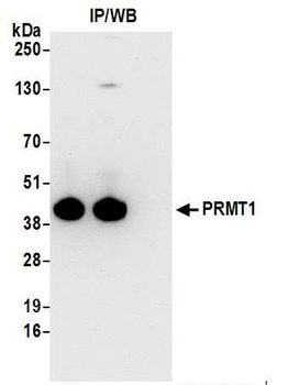 PRMT1 Antibody