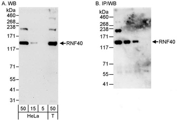 RNF40 Antibody