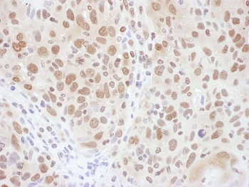 Rabbit anti-RNF20 Antibody