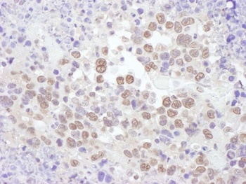 Rabbit anti-RNF20 Antibody