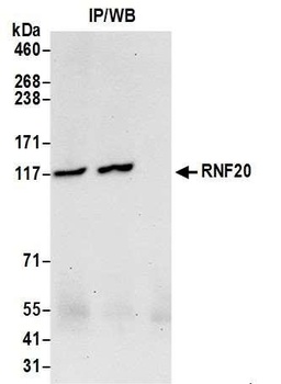 RNF20 Antibody
