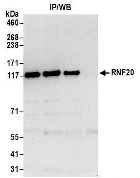 Rabbit anti-RNF20 Antibody