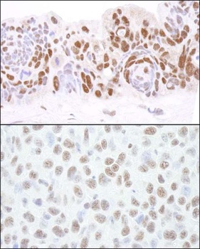 Rabbit HDAC1 Antibody