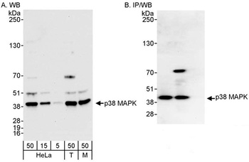 Rabbit anti-p38 MAPK Antibody