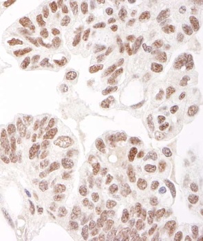 Rabbit HDAC2 Antibody