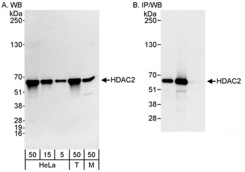 Rabbit HDAC2 Antibody