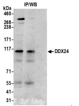 DDX24 Antibody