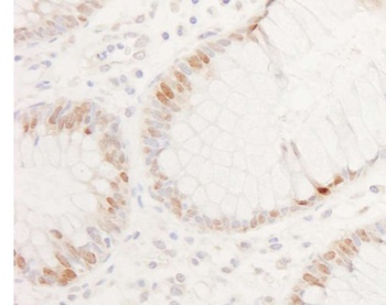 Rabbit CDX2 Antibody