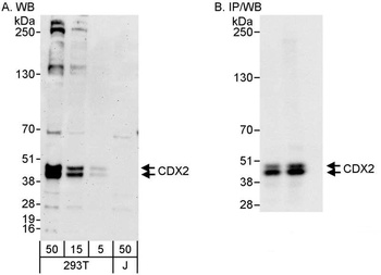 Rabbit CDX2 Antibody