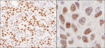 Rabbit anti-hnRNP-U Antibody