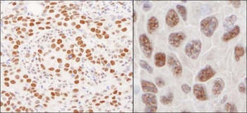 hnRNP-U Antibody