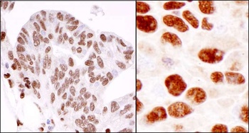 Rabbit hnRNP-K Antibody
