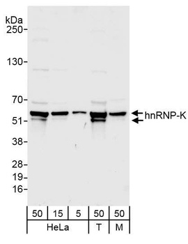 Rabbit hnRNP-K Antibody