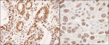 Rabbit hnRNP-K Antibody