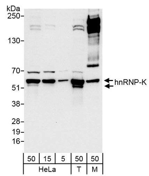 Rabbit hnRNP-K Antibody