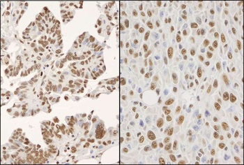 Rabbit hnRNP-K Antibody