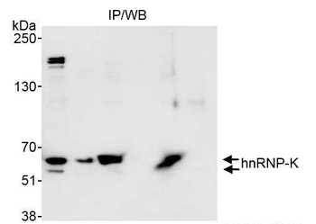 Rabbit hnRNP-K Antibody
