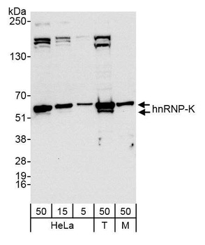 Rabbit hnRNP-K Antibody