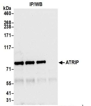 Rabbit anti-ATRIP Antibody