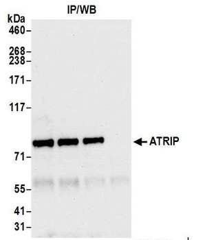 ATRIP Antibody