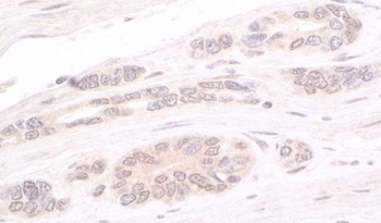 Rabbit anti-ATRIP Antibody