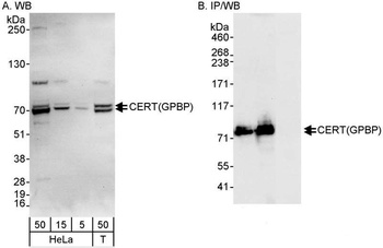 Rabbit anti-CERT/GPBP Antibody
