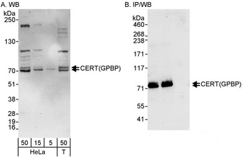 Rabbit anti-CERT/GPBP Antibody