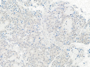 Rabbit anti-Tip41 Antibody