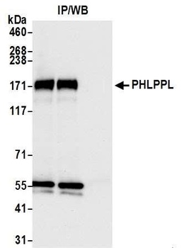 PHLPPL Antibody