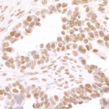 Rabbit anti-Phospho RNA Polymerase II (S2) Antibody