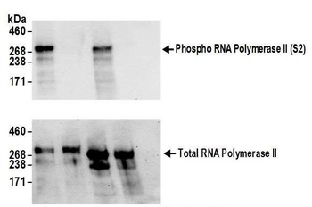 Rabbit anti-Phospho RNA Polymerase II (S2) Antibody