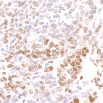 Rabbit anti-Phospho RNA Polymerase II (S2) Antibody
