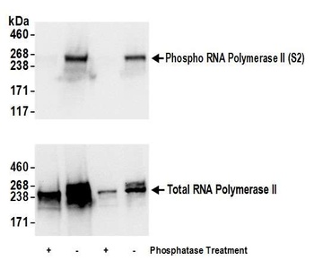 Rabbit anti-Phospho RNA Polymerase II (S2) Antibody