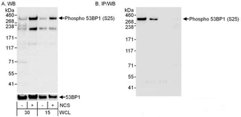 Rabbit anti-Phospho 53BP1 (S25) Antibody