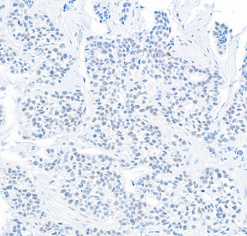 Rabbit anti-DEC1 Antibody