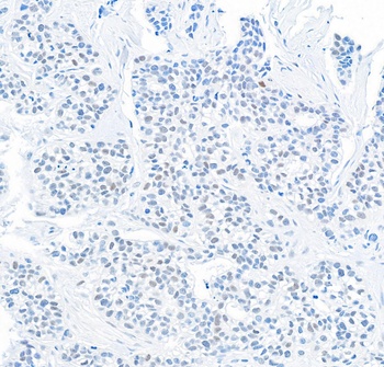 DEC1 Antibody