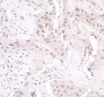 Rabbit GAPDH Antibody