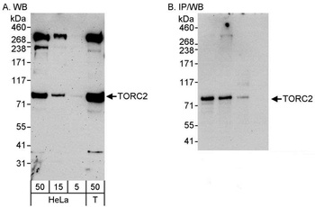 Rabbit TORC2 Antibody