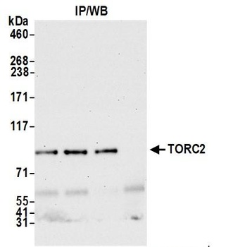 Rabbit TORC2 Antibody