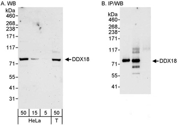 Rabbit anti-DDX18 Antibody