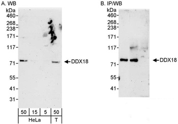 Rabbit anti-DDX18 Antibody