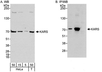 Rabbit anti-KARS Antibody