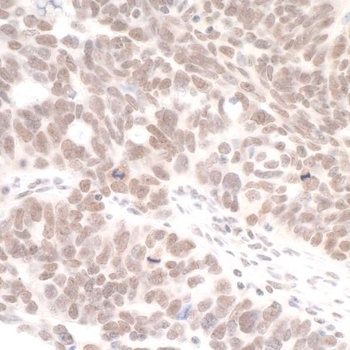 Rabbit anti-DHX8 Antibody