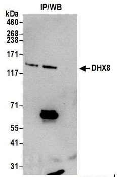 DHX8 Antibody