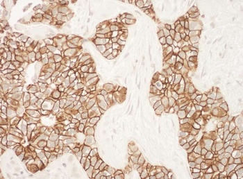 Rabbit ErbB2 Antibody