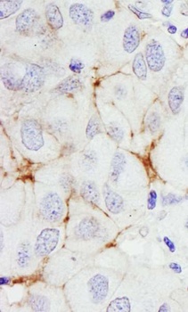 Rabbit ErbB2 Antibody