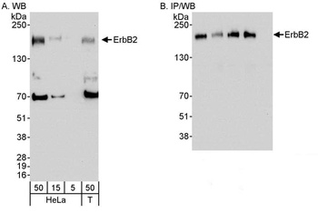 Rabbit ErbB2 Antibody