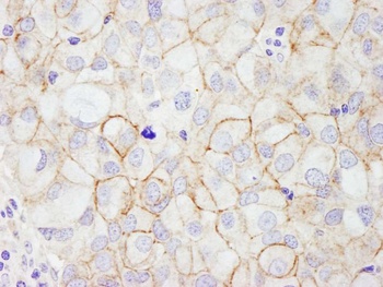 Rabbit ErbB2 Antibody