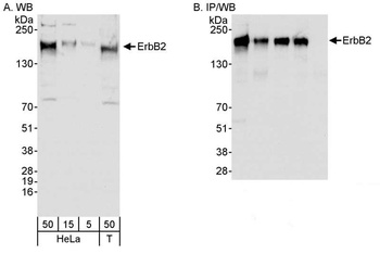 Rabbit ErbB2 Antibody
